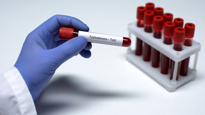 TESTOSTERON